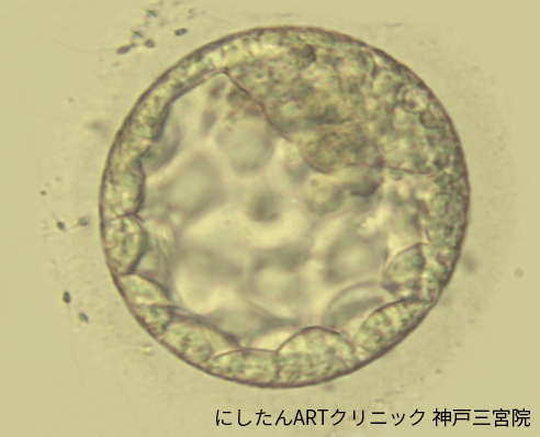 胚盤胞写真