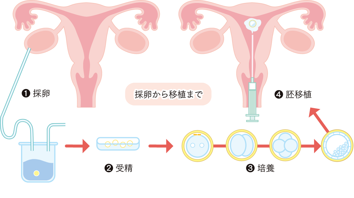 ※採卵から移植の図