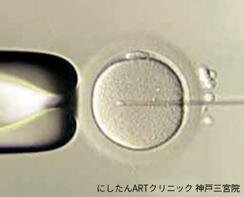 顕微授精の様子