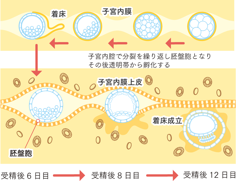 着床